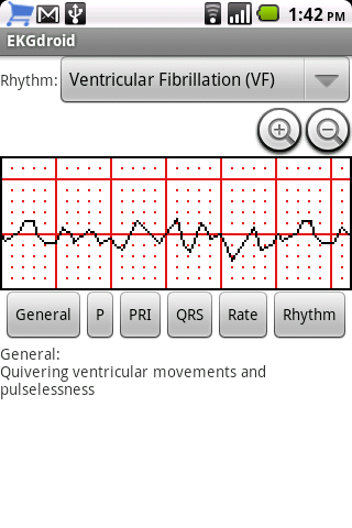 EKGdroid Android Health