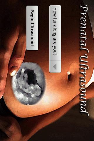 Prenatal Ultrasound Android Lifestyle