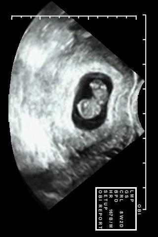 Prenatal Ultrasound Lite Android Medical