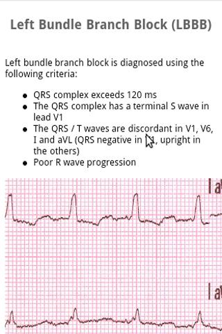 Pocket EKG – 12 Lead Basic Android Books & Reference