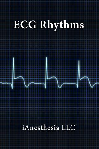 ECG Rhythms (The EKG Guide) Android Health