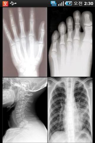 XrayCamera