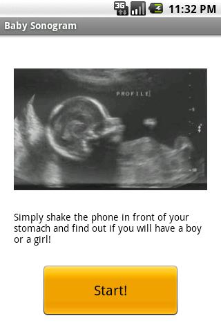 Baby Sonogram Android Casual